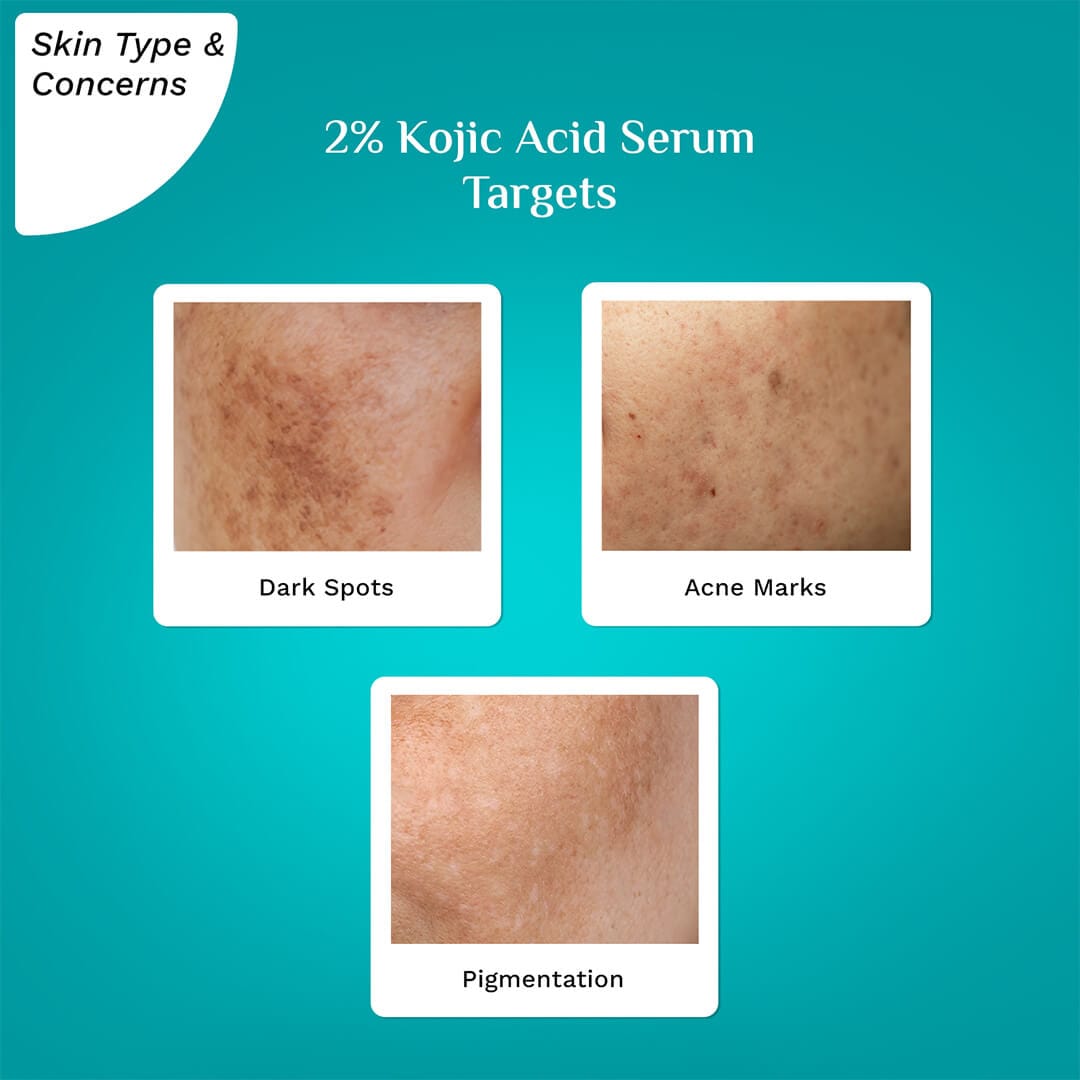 2 KojicAcidSerum 1080x1080 Skin Type Targets 0a09c97b 7c23 45ec a7c6 3d0610e9ebbf