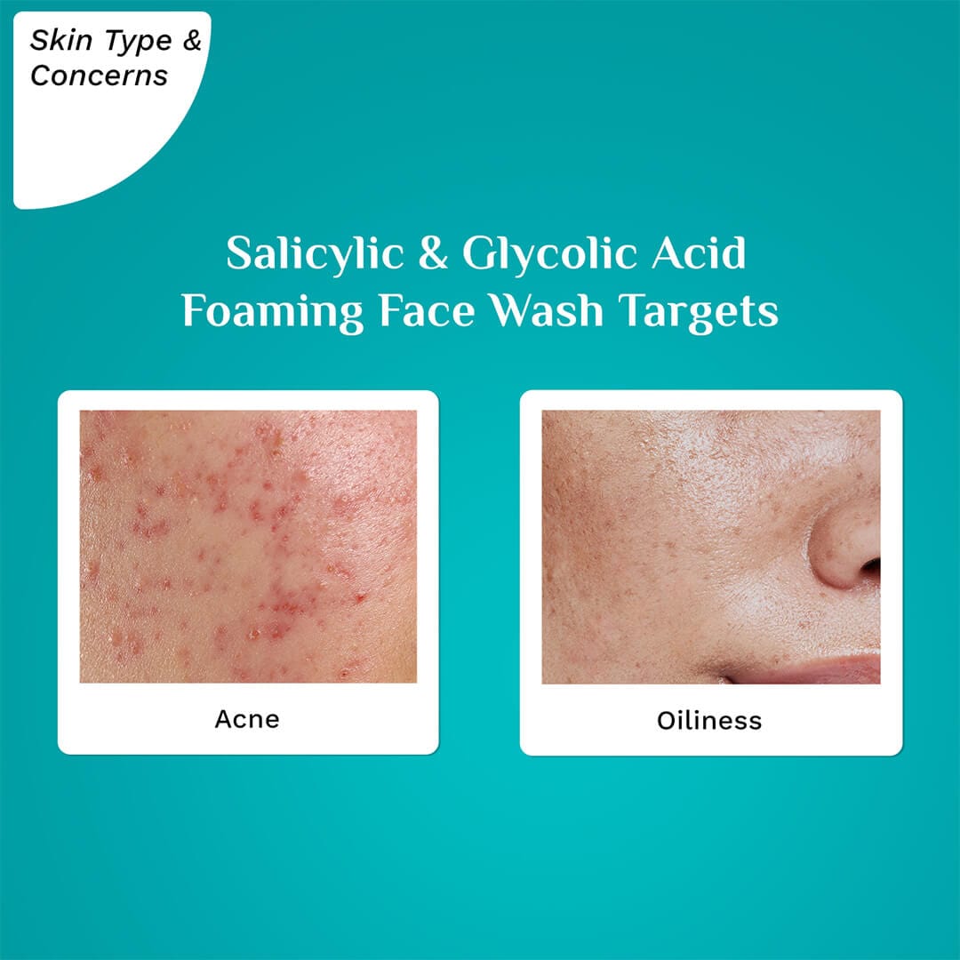 Salicylic GlycolicAcidFoamingFaceWash 1080x1080 Skin Type Targets
